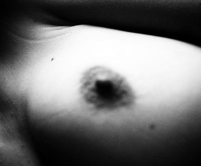 La fin des prothèses mammaires PIP